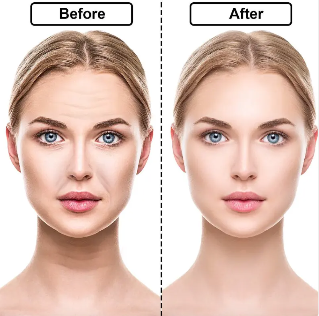 Silicone Anti-wrinkle Stickers