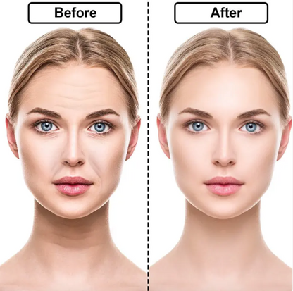 Silicone Anti-wrinkle Stickers
